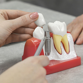 Are most people happy with dental implants?