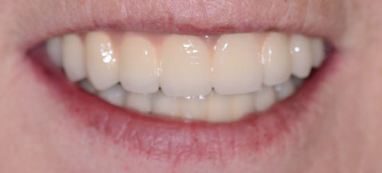 After dental treatment image4