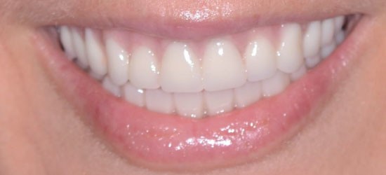 After dental treatment image1