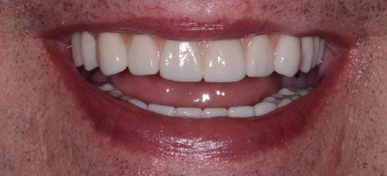 After dental treatment image7