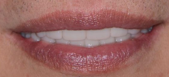 After dental treatment image5
