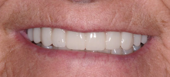 After dental treatment image6