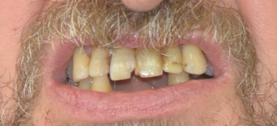 Before dental treatment image3