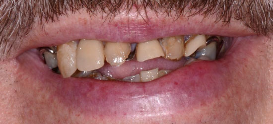 Before dental treatment image2