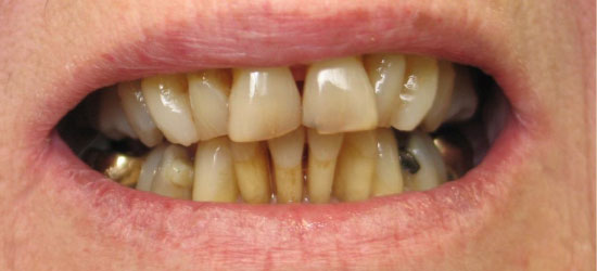 Before dental treatment image1