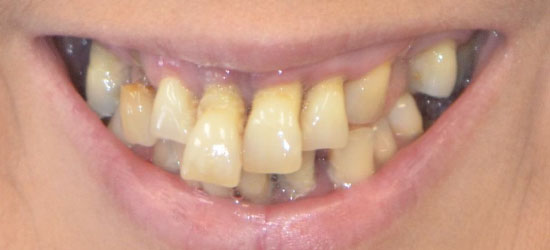 Before dental treatment image7