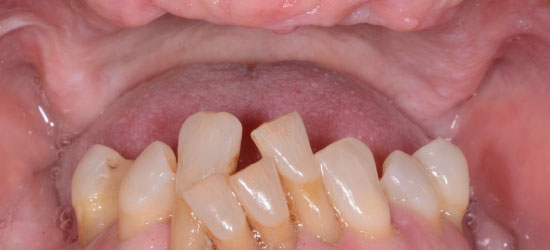 Before dental treatment image6