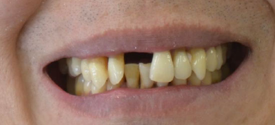 Before dental treatment image4