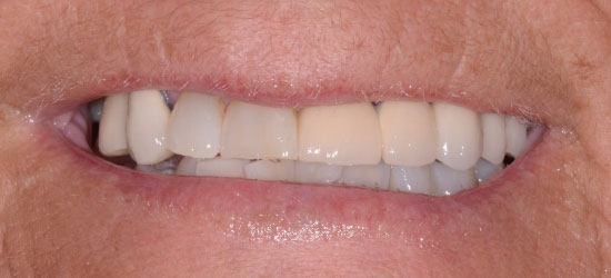 Before dental treatment image5