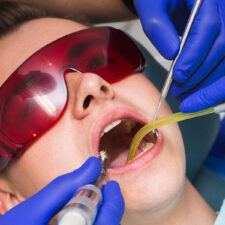 What Happens if You Leave a Black Tooth?