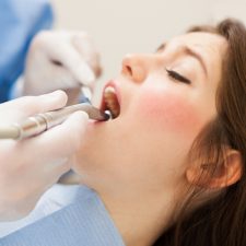 What to Expect When Going to a Dental Exam and Cleaning: A Step-by-Step Guide