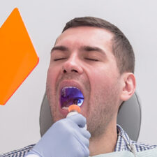 Post-Extraction Care: How to Take Care of Your Mouth After a Tooth Removal